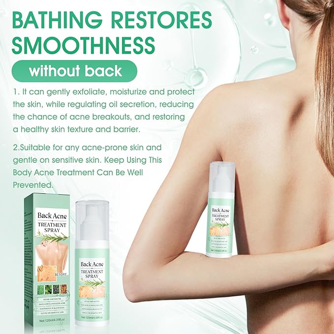 Spray Antiacné Corporal – Limpieza Profunda y Cuidado de la Piel