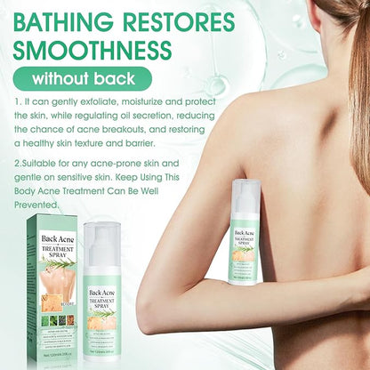 Spray Antiacné Corporal – Limpieza Profunda y Cuidado de la Piel