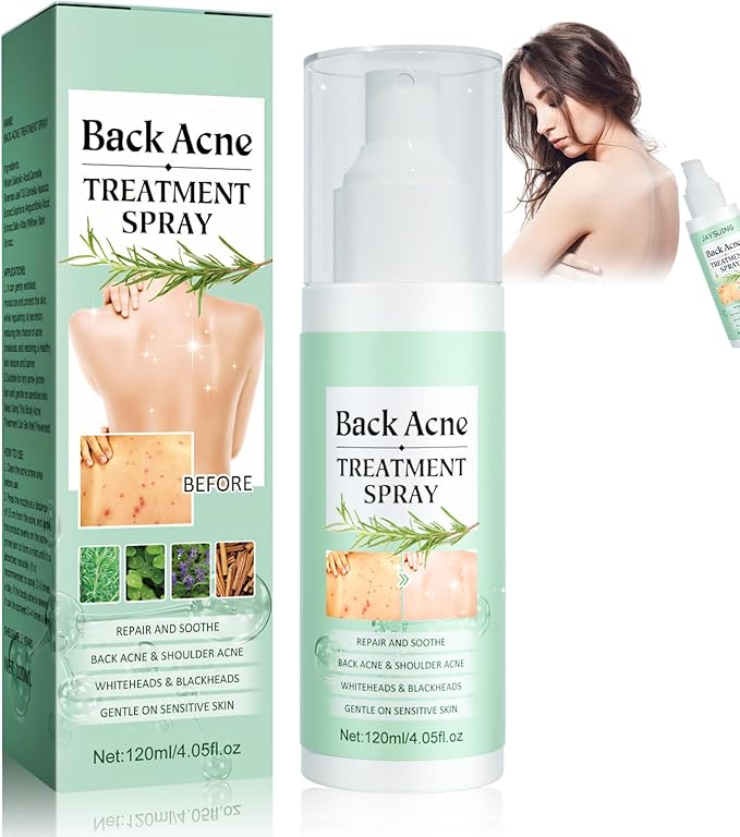 Spray Antiacné Corporal – Limpieza Profunda y Cuidado de la Piel