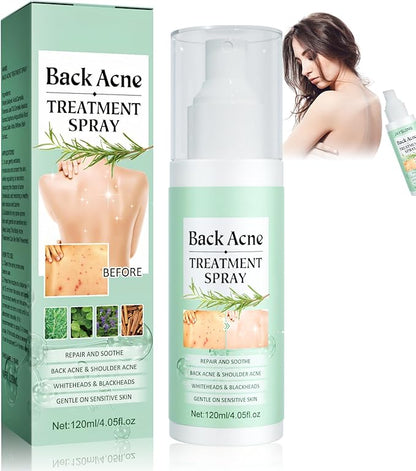 Spray Antiacné Corporal – Limpieza Profunda y Cuidado de la Piel