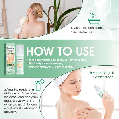 Spray Antiacné Corporal – Limpieza Profunda y Cuidado de la Piel